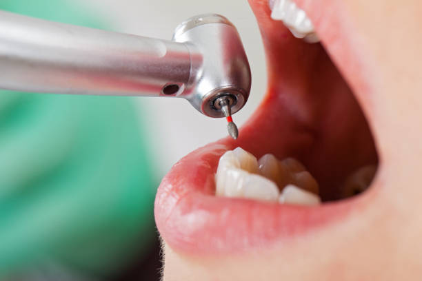 Best After-Hours Emergency Dentist in Mission Bend, TX